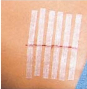 皮膚が薄い!!(2024/04/07)