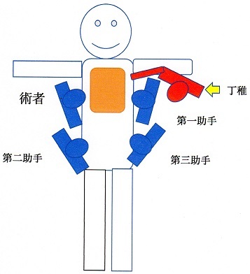 医者の労働時間 その6 手術室 その2(2017/11/09)